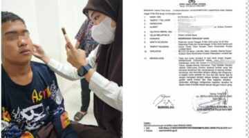Ketua Setwil FPII NTB Polisikan Dugaan Kekerasan Terhadap Anak Siswa SMP Islam Nurul Madinah